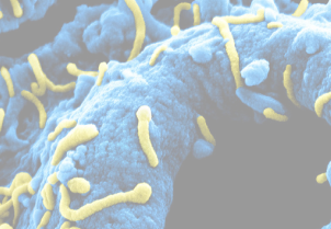 diagnostiek Marburg virus